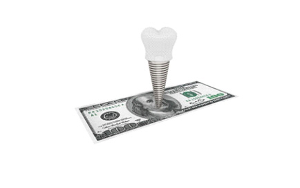 Can Dental Implants Save You Money in the Long Run?